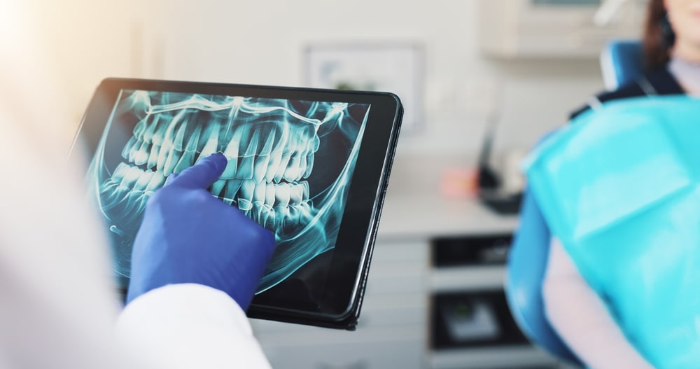 dental plans - SmileMakers