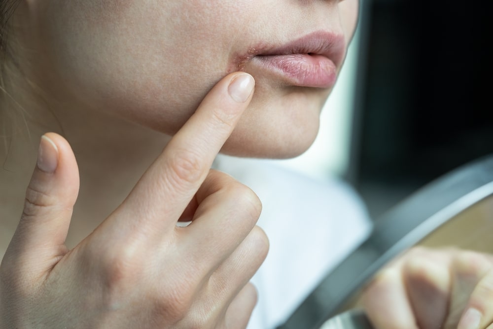 mouth-microbiome