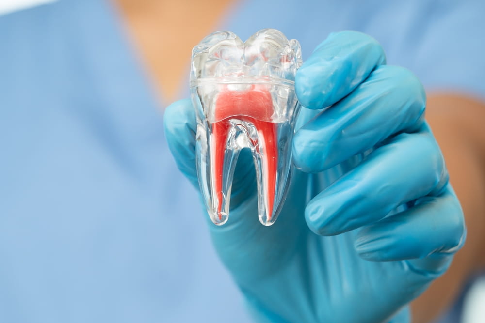 root-canal-dentist-brampton