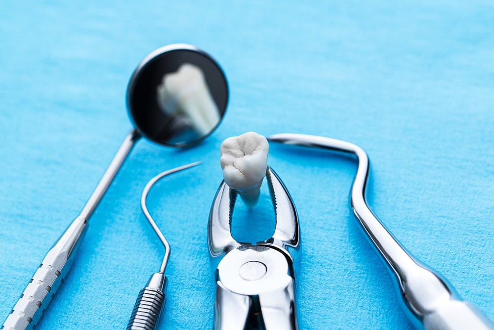 teeth-checkup