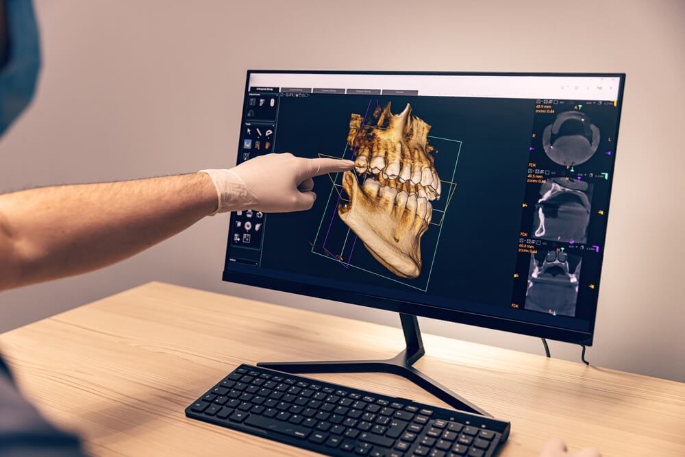 A gloved hand points at a dental 3D scan displayed on a monitor, showing detailed teeth and jaw images. The setting is clinical and professional.