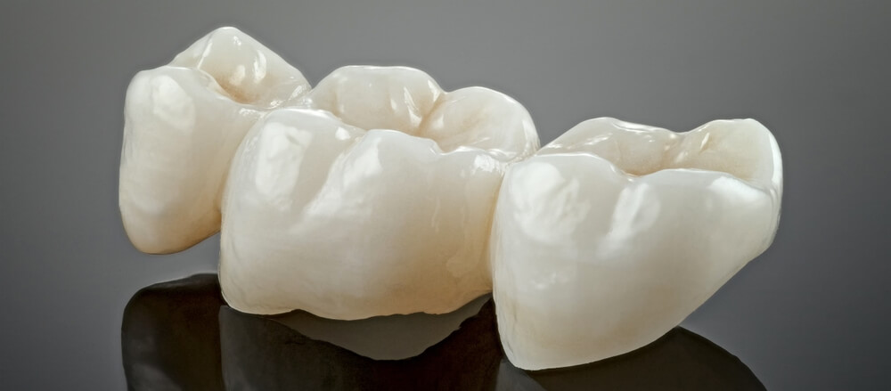 A close-up image of three shiny, white dental crowns placed together on a reflective dark surface, displaying smooth surfaces and realistic contours.