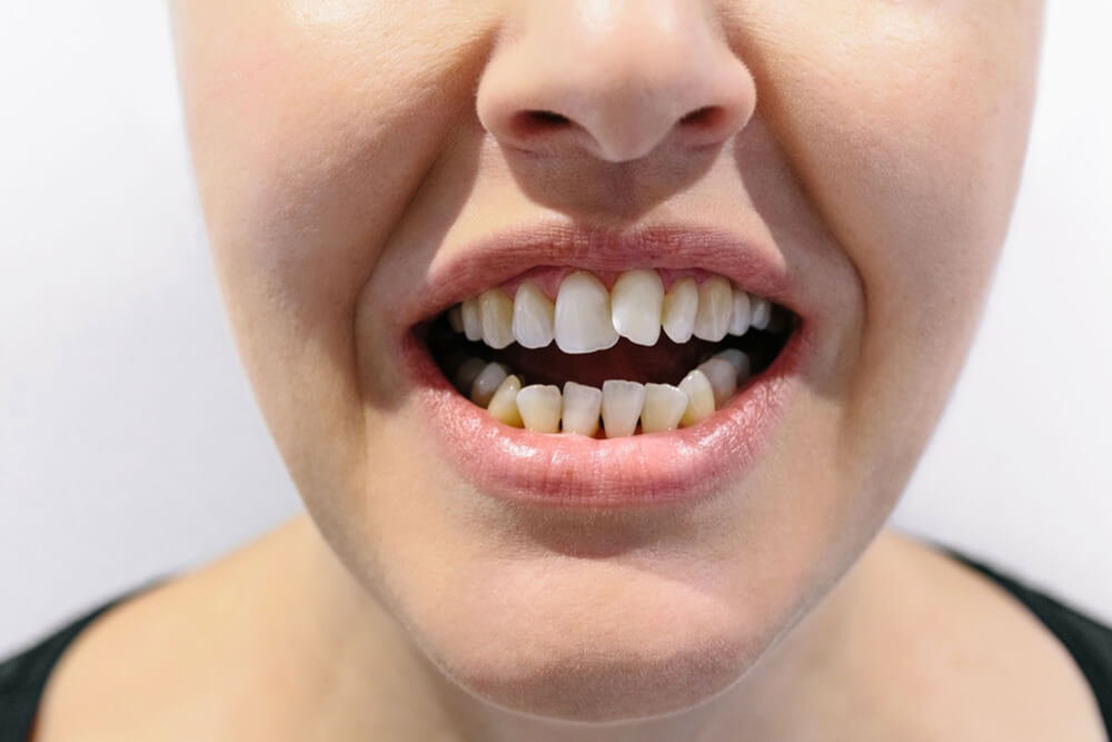 A woman with a bright smile, highlighting the significance of space maintainers in children's dental care.