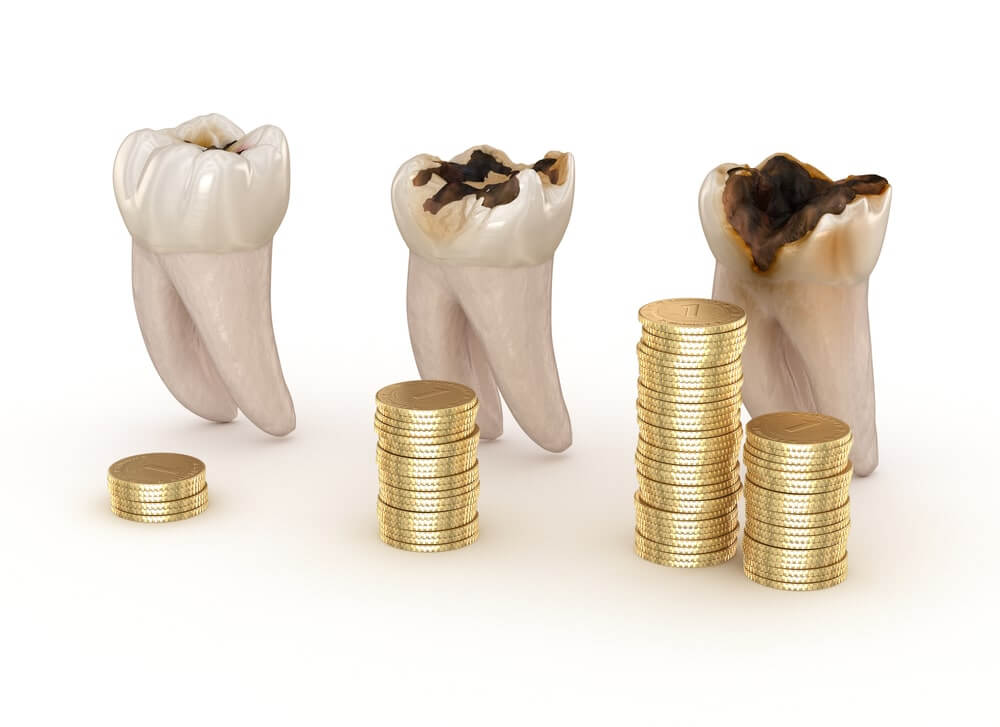 cost-of-dental-insurance