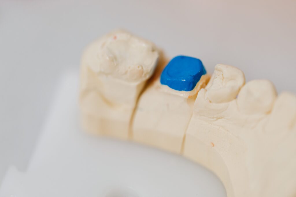 dental filling