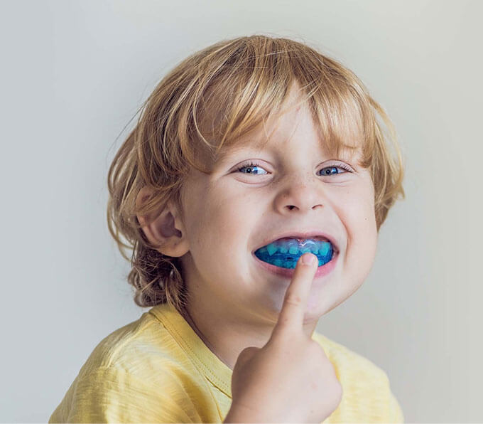 Mouth Guards