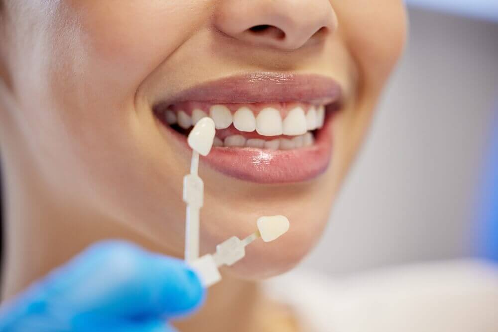 A smiling woman proudly displaying her bright smile, likely enhanced with porcelain veneers.