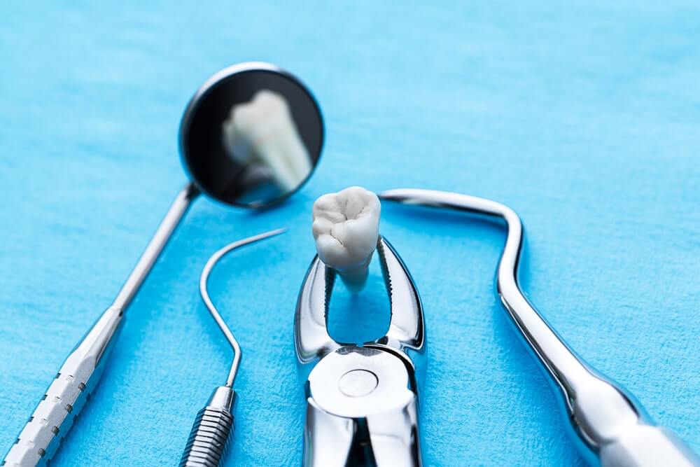 teeth-checkup